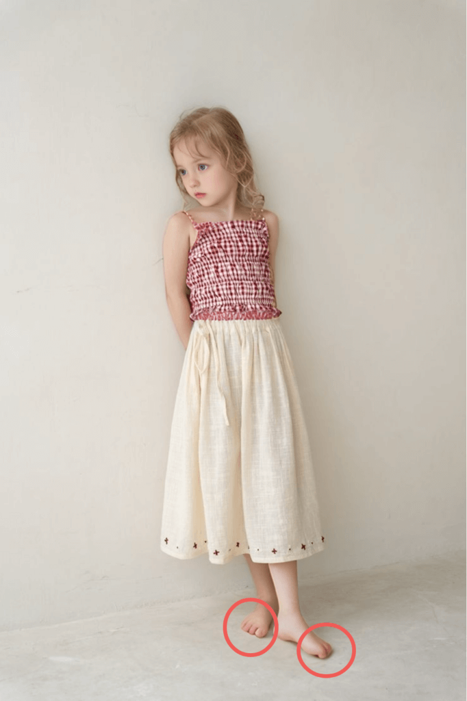 ai feet problem image kid feet